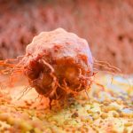Your Gut Bacteria May Reveal How Cancer Treatment Is Affecting You