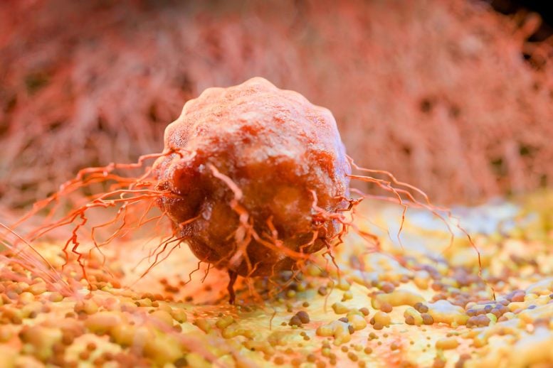 Your Gut Bacteria May Reveal How Cancer Treatment Is Affecting You