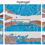 FDA-approved drug could be repurposed to relieve osteoarthritis pain and protect cartilage: ScienceAlert