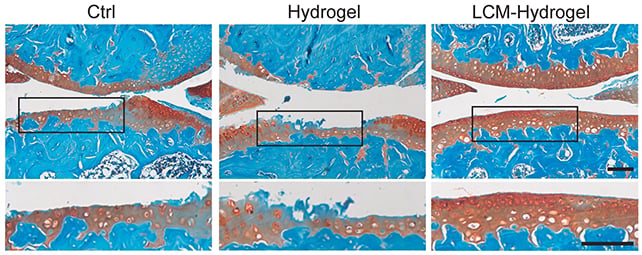 FDA-approved drug could be repurposed to relieve osteoarthritis pain and protect cartilage: ScienceAlert
