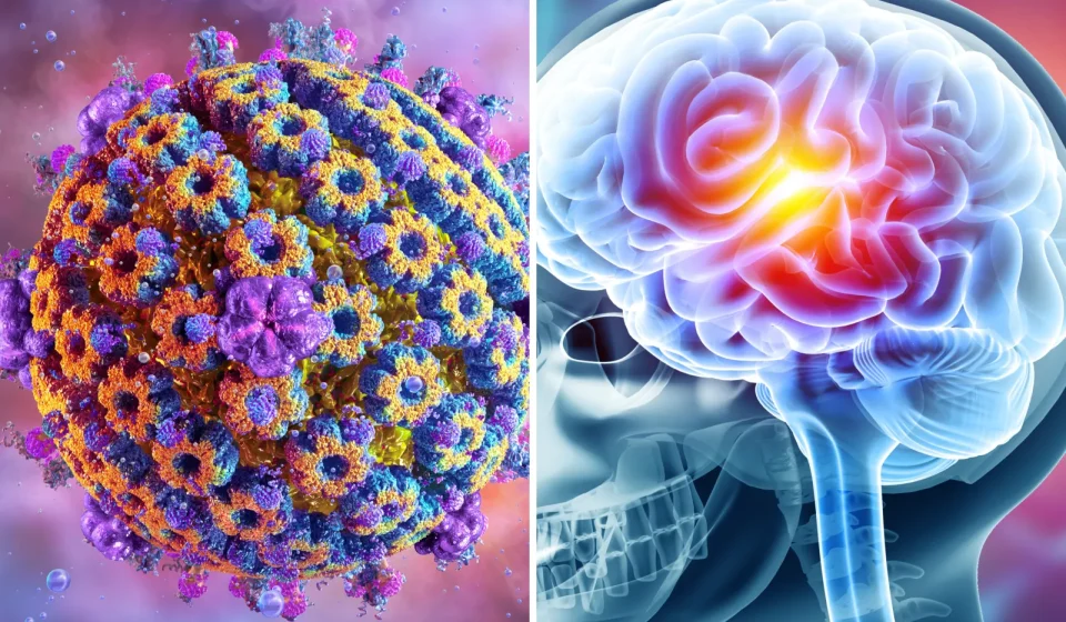 Virus affecting 60 percent of people could provide clues about Alzheimer's risk