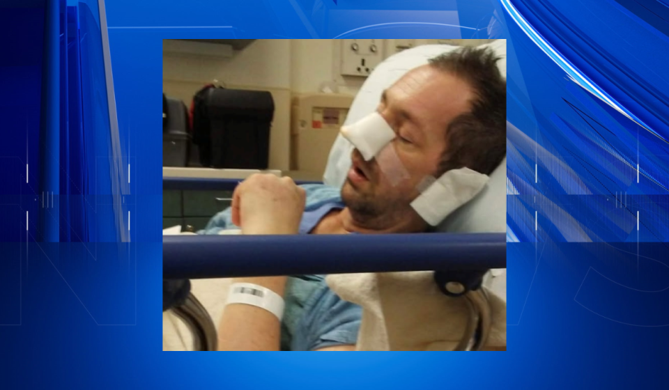 Former motocross racer explains how opioid addiction led to fentanyl use, sepsis and loss of his nose