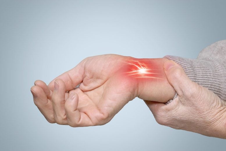 Scientists Discover Surprisingly Simple Way to Relieve Stubborn Carpal Tunnel Pain