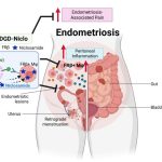 Tapeworm treatment shows early effectiveness against endometriosis: ScienceAlert