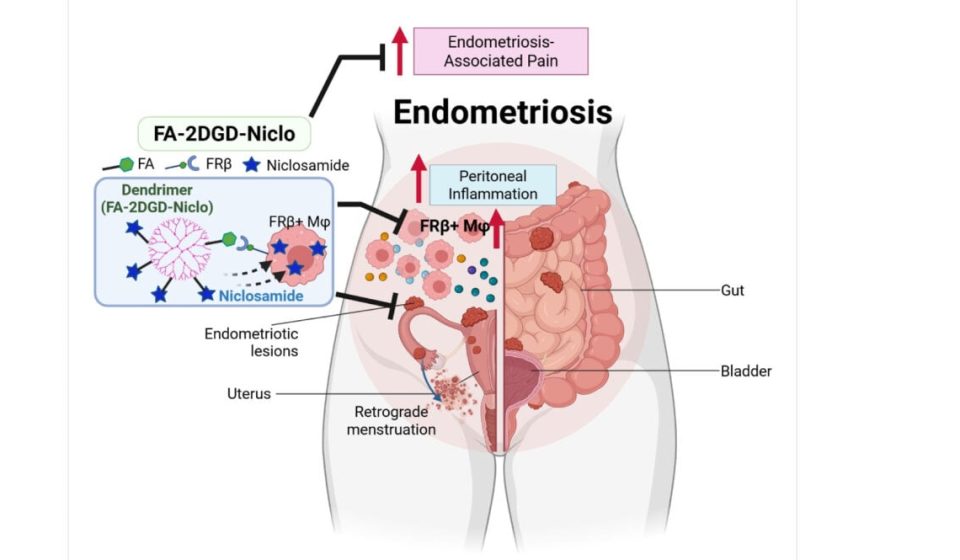 Tapeworm treatment shows early effectiveness against endometriosis: ScienceAlert