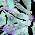 Beyond cigarettes: discovering the causes of lung cancer in non-smokers - The Washington Post