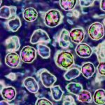 Unvaccinated 39-year-old woman becomes 6th measles death in Pennsylvania