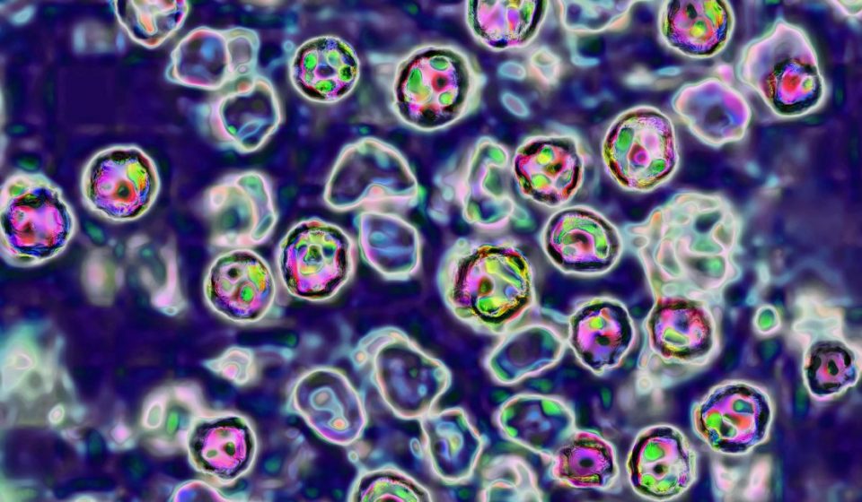 Unvaccinated 39-year-old woman becomes 6th measles death in Pennsylvania