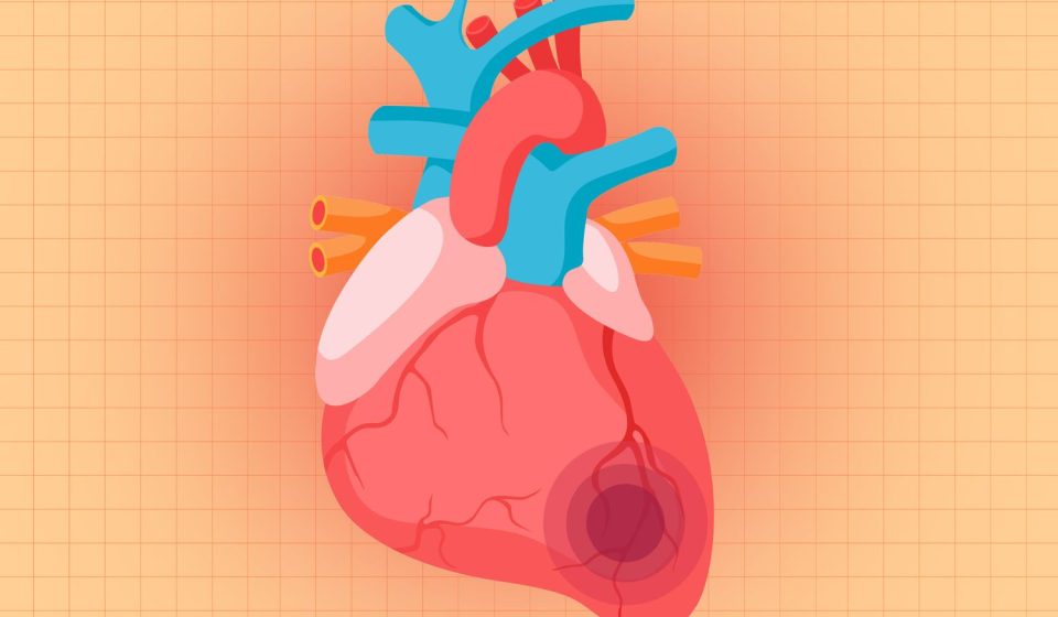 More than half of people with this serious heart health risk don’t even know they have it, according to a new study. More than half of people with this serious heart health risk don't even know they have it, according to a new study.