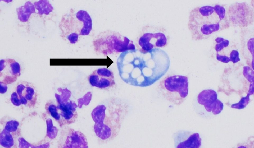 The brain-eating amoeba kills 97% of its victims. Scientists may have found a way to stop it within hours The brain-eating amoeba kills 97% of its victims. Scientists may have found a way to stop it within hours