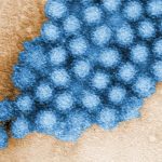 Norovirus outbreak confirmed at metro area elementary school with approximately 85 cases reported
