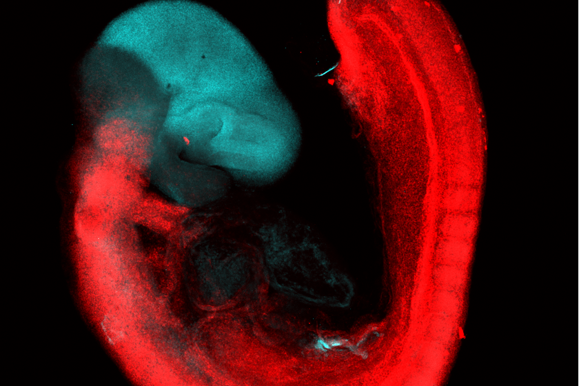 The brain may have come from two separate nervous systems that were crushed, study suggests