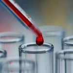 Routine blood test could predict dementia risk 15 years in advance