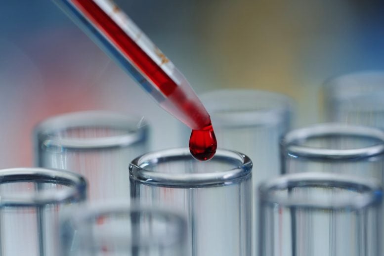 Routine blood test could predict dementia risk 15 years in advance Routine blood test could predict dementia risk 15 years in advance
