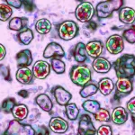 Measles can erase up to 73 percent of your immune system's memory