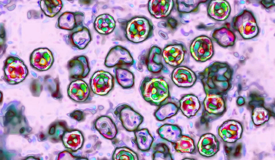 Measles can erase up to 73 percent of your immune system's memory
