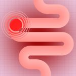 Scientists Just Connected 2 Types of Ultra-Processed Foods to Reduce Colon Cancer Risk