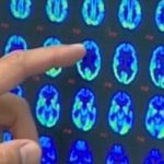 Healthier Hawaii: Warning Signs of Dementia, Tips for a Healthy Aging Brain