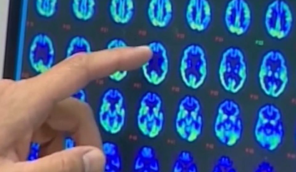 Healthier Hawaii: Warning Signs of Dementia, Tips for a Healthy Aging Brain