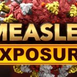Lewis County: All 11 measles cases are in one town