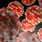 More than 150 measles cases now confirmed in Kentucky outbreak