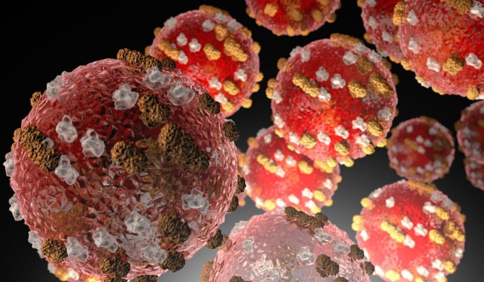 More than 150 measles cases now confirmed in Kentucky outbreak