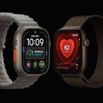 Apple Watch Series 12 and Ultra 4 owners report skin irritation