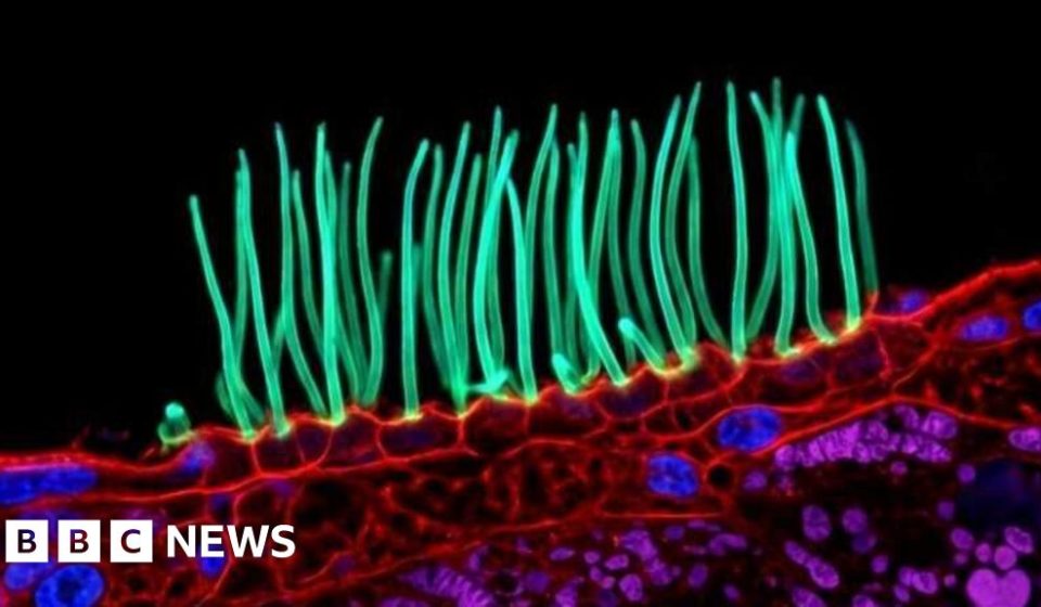 Award-winning image that sparked backlash was generated by AI, according to Nikon rules – BBC News Africa Award-winning image that sparked backlash was generated by AI, according to Nikon rules - BBC News Africa