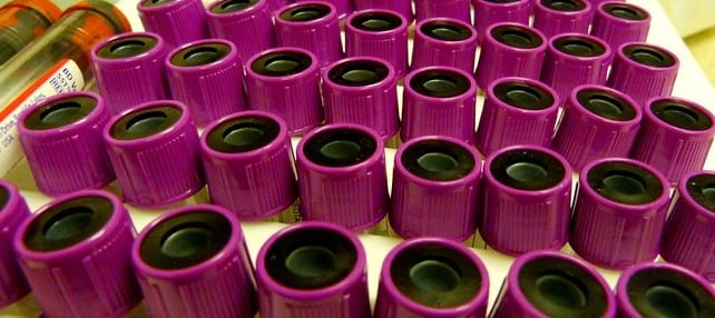 We may have been wrong to fast before blood tests, study reveals: ScienceAlert