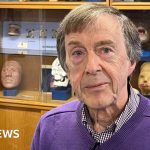 'I could never hear on my left side - until I got a prosthetic ear' - BBC