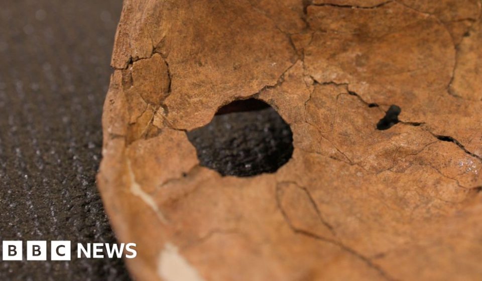 Hole in Neanderthal shoulder bone linked to ancient wooden spear Hole in Neanderthal shoulder bone linked to ancient wooden spear