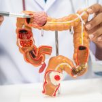 4 “different” and more dangerous symptoms of colorectal cancer in adolescents