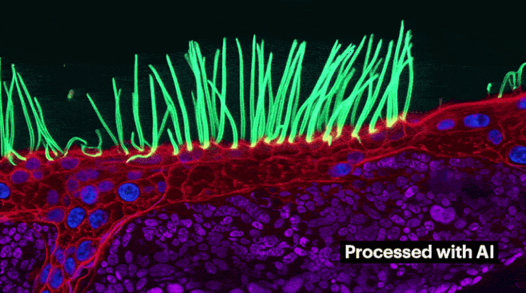 Award-winning microscopy image disqualified for use of AI