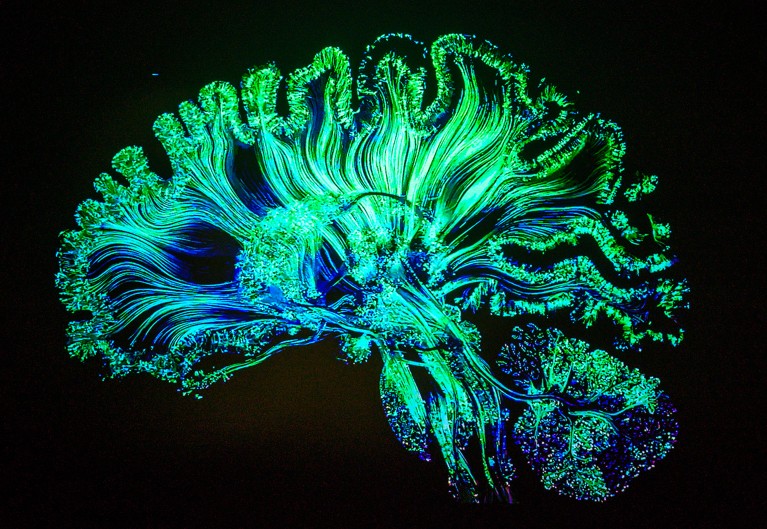 Microdosing LSD Has Some Cognitive Benefits – But Only for Women