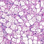 Neglected brown fat in our bodies linked to a wide range of health benefits