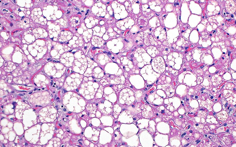 Neglected brown fat in our bodies linked to a wide range of health benefits