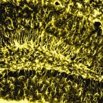 Memory remains strong in old age when this brain enzyme is active