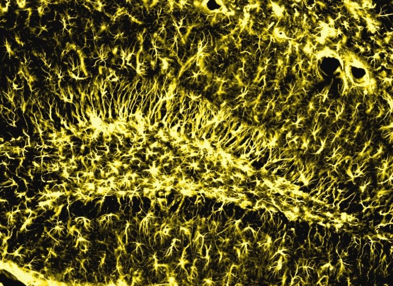 Memory remains strong in old age when this brain enzyme is active