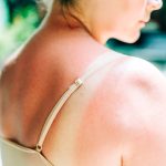Moderna mRNA vaccine almost halves risk of skin cancer recurrence