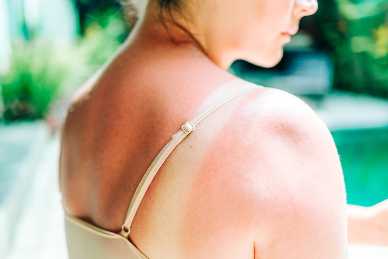 Moderna mRNA vaccine almost halves risk of skin cancer recurrence