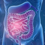 IBS Symptoms Improved by FODMAP Targeting Enzyme Combination