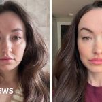 Does the “ferritin face” really exist? And can you really tell low iron from looks? -BBC