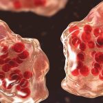 Central Minnesota county reports 'several suspected cases of measles'