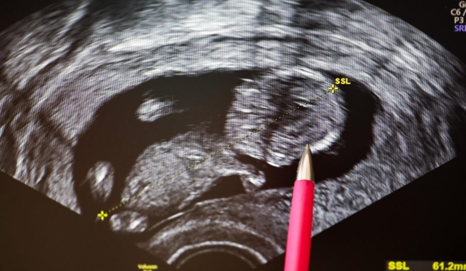 Should you undergo genetic testing before having a child?