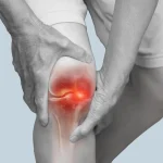 A Surprisingly Simple Way to Relieve Arthritic Knee Pain Without Pills or Surgery