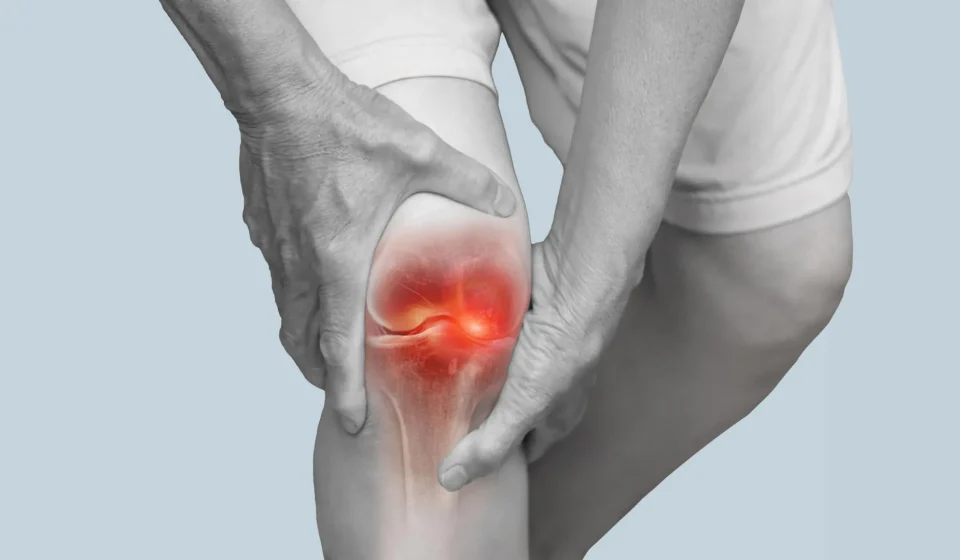 A Surprisingly Simple Way to Relieve Arthritic Knee Pain Without Pills or Surgery