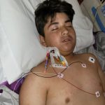 13-year-old California boy is in dire condition after contracting a rare disease