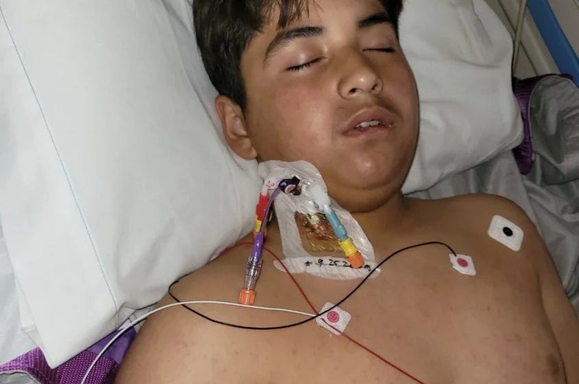 13-year-old California boy is in dire condition after contracting a rare disease