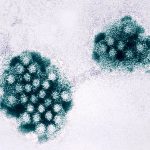 Nearly 100 students and staff fell ill due to norovirus outbreak at Kansas elementary school