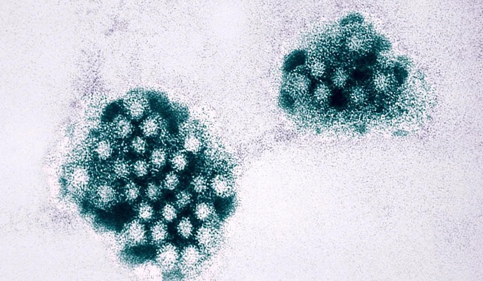Nearly 100 students and staff fell ill due to norovirus outbreak at Kansas elementary school Nearly 100 students and staff fell ill due to norovirus outbreak at Kansas elementary school